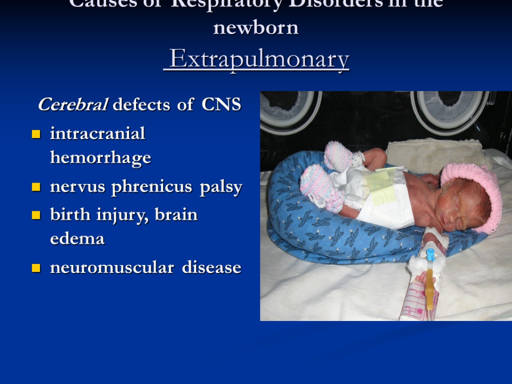 Causes of Respiratory Disorders in the newborn Extrapulmonary Cerebral defects of CNS intracranial hemorrhage